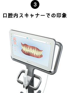 03.口腔内スキャナーでの印象